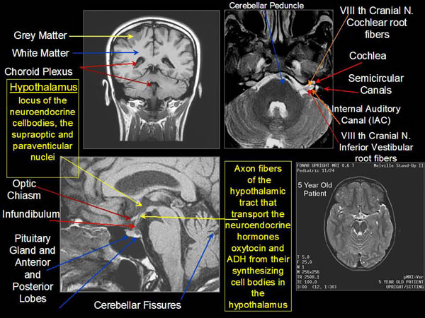 Fig. 12a-12d. Further examples of the exceptional anatomic detail made visible by the discovery of Damadian of the pronounced differences in the decay rates (relaxations) of the NMR signals of the body's normal tissues.
