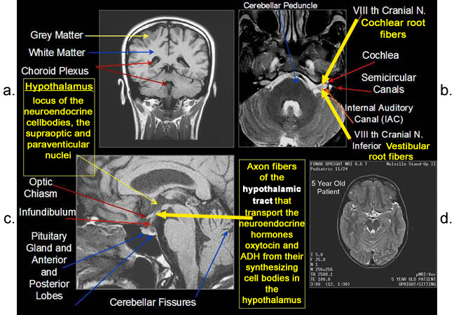 Fig. 12a-12d. Further examples of the exceptional anatomic detail made visible by the discovery of Damadian of the pronounced differences in the decay rates (relaxations) of the NMR signals of the body's normal tissues.