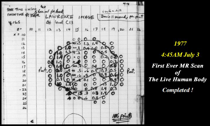 First MR scan notebook data