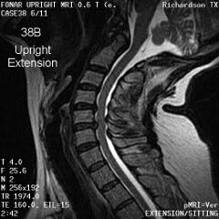 MRI of the L-spine