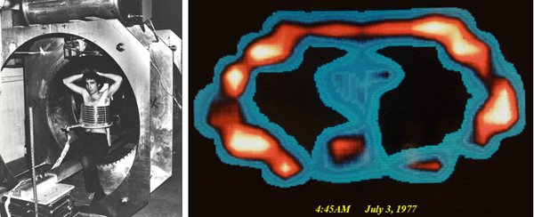 On the Accomplishment of the World's First MRI Scan 