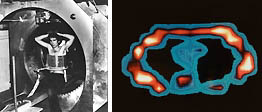 World's First MRI Scan of the Live Human Body