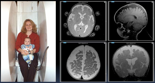 The Mommy and Me MRI