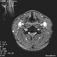 Stand-Up MRI Case Study