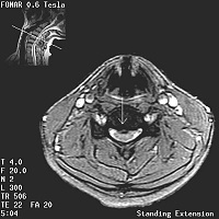 Stand-Up MRI Case Study