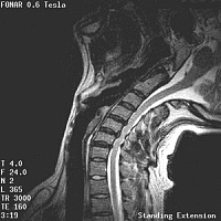 Stand-Up MRI Case Study