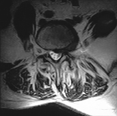 FONAR Spondylography - Standing