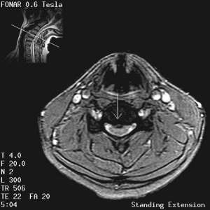 Fonar Stand-Up (TM) MRI Image