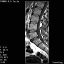 no5_lumbar_t1