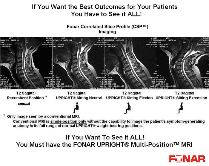 Fonar Correlated Slice Profile (CSP )(TM)