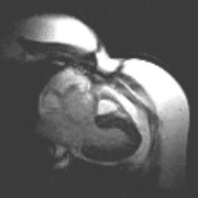 Fonar Upright Heart Movie