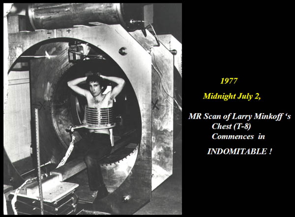 Figure 18. L. Minkoff in Indomitable with some room to spare inside the Goldsmith receiver coil.