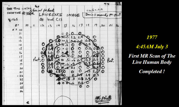 Fig.19. The data of the first live human MRI scan of L. Minkoff's chest consisting of 106 data points acquired over four hours and forty five minutes.