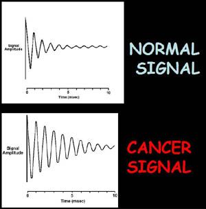 Fig.6. He discovered that the NMR signal amplitudes of cancer tissue differ markedly from the NMR signal amplitudes of the normal tissues because of the differences in their rate of decay. 