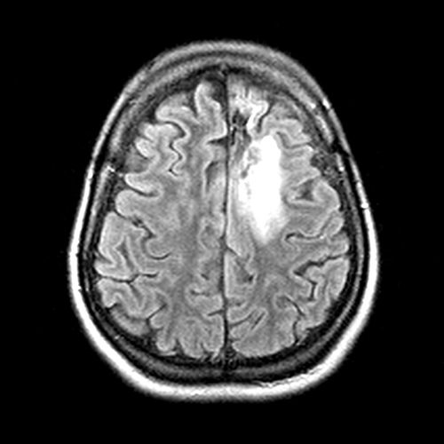 MRI Image