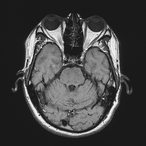 MRI Image