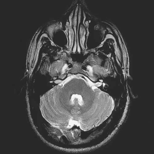 MRI Image