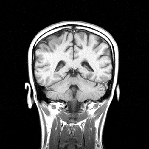 MRI Image