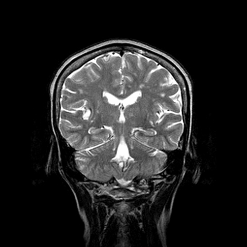 MRI Image