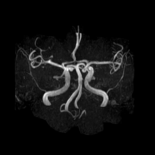 MRI Image