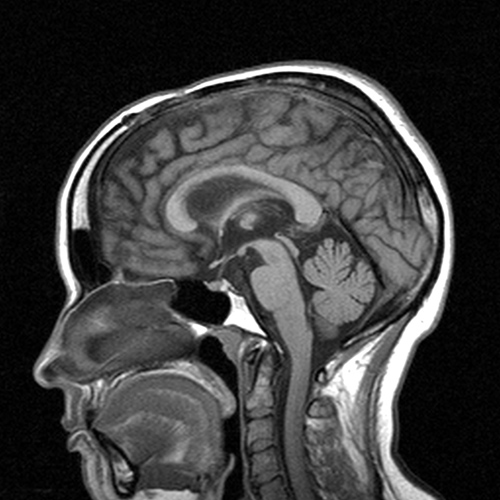 MRI Image