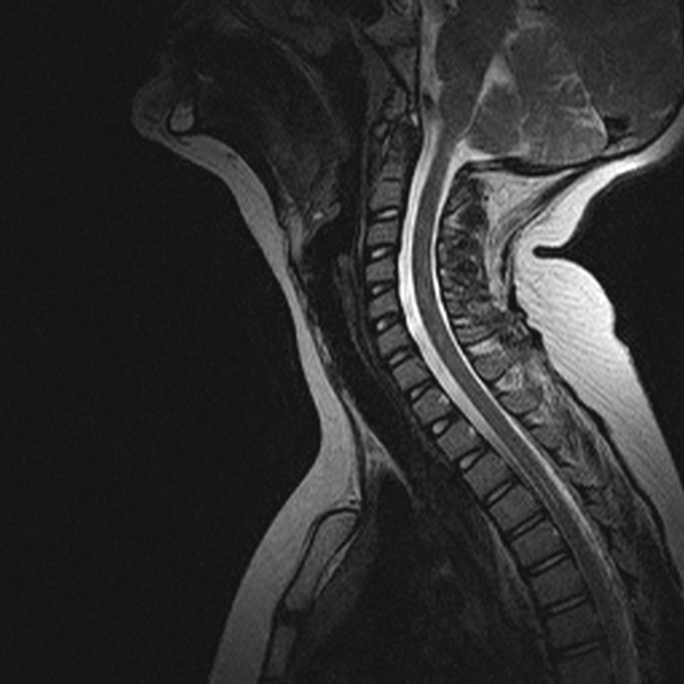 MRI Image