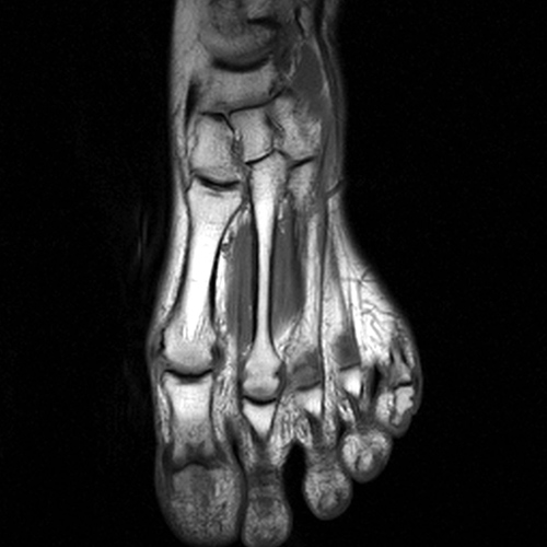 MRI Image