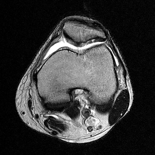 MRI Image