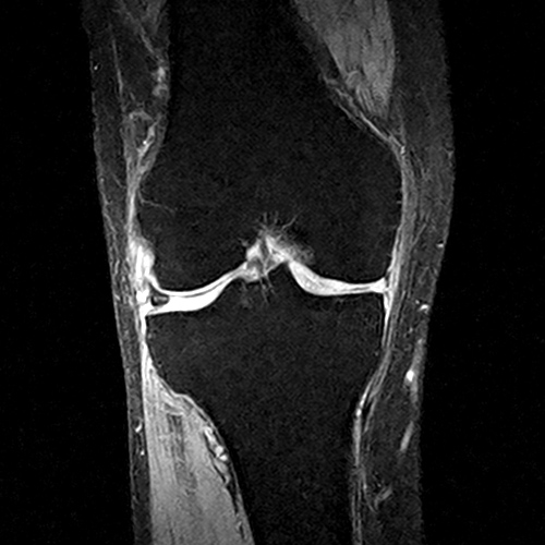 MRI Image