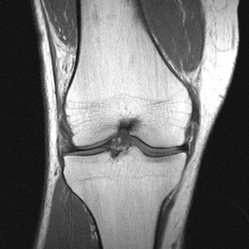 MRI Image