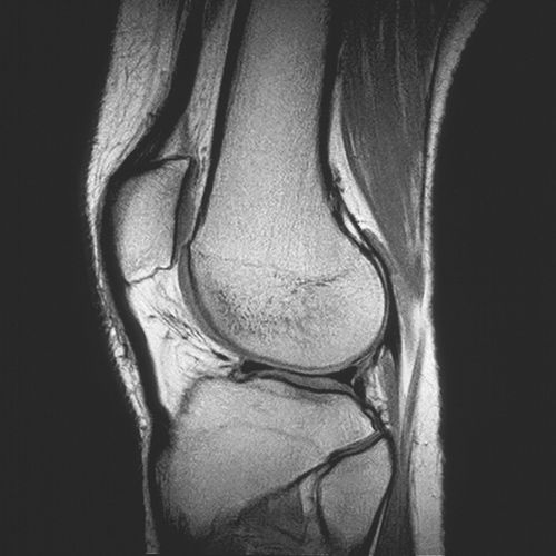 MRI Image