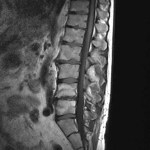 MRI Image