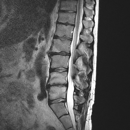 MRI Image