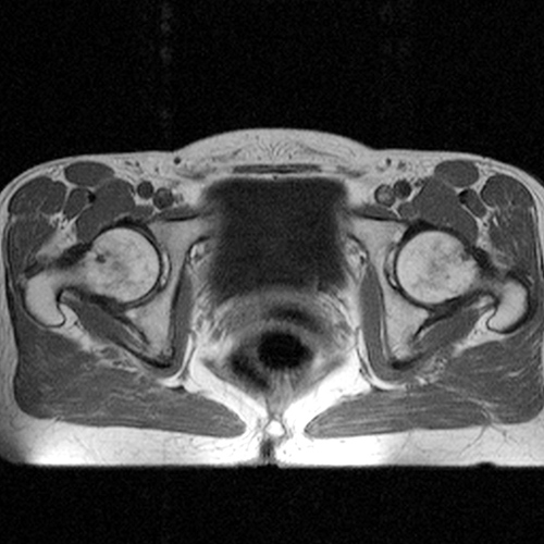 MRI Image