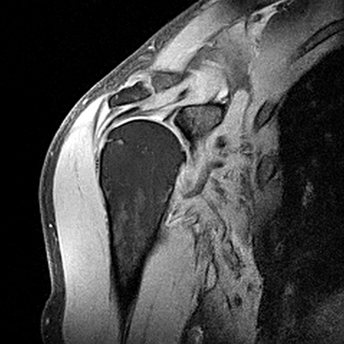 MRI Image