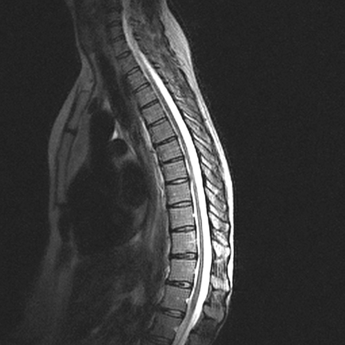 MRI Image