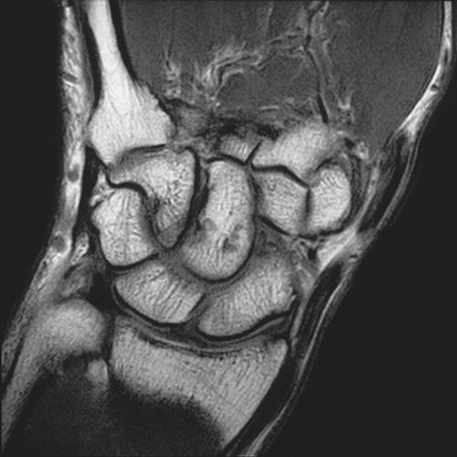 MRI Image