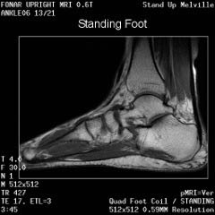 MRI of the foot