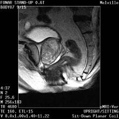 Prostate MRI