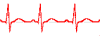 FIRST fiber-optic cardiac-gated imaging