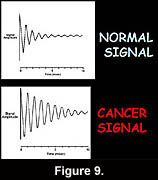Fig.6. He discovered that the NMR signal amplitudes of cancer tissue differ markedly from the NMR signal amplitudes of the normal tissues because of the differences in their rate of decay. 