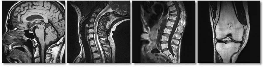 FONAR Upright MRI