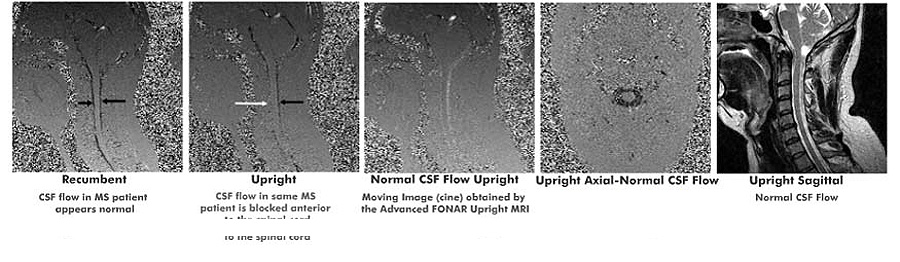 FONAR Upright MRI